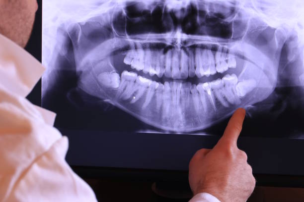Best Weekend Emergency Dentist in Saranac, MI